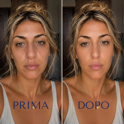 Lumivia® — Dispositivo Modellante EMS per il Naso
